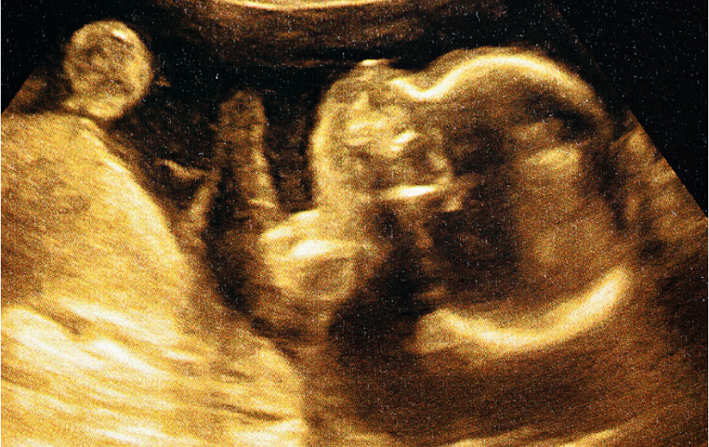 Background image representing Lasting Health
